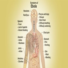 بیماری ابولا